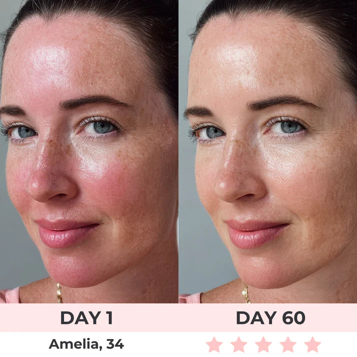 Glow Sculpt LED Red Light Therapy Face Mask