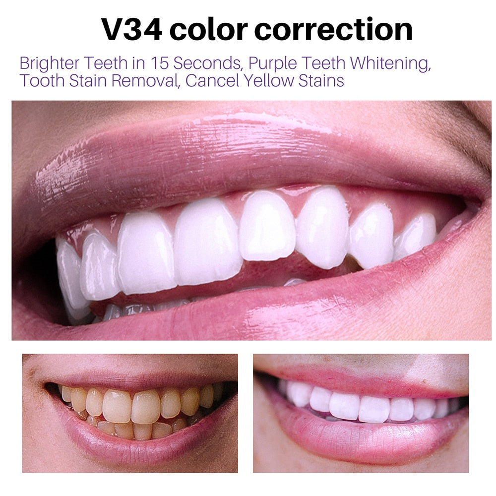 "Unveil Your Radiant Smile: Teeth Whitening Mousse, the Ultimate Solution for Deep Cleaning and Restoring Confidence!"