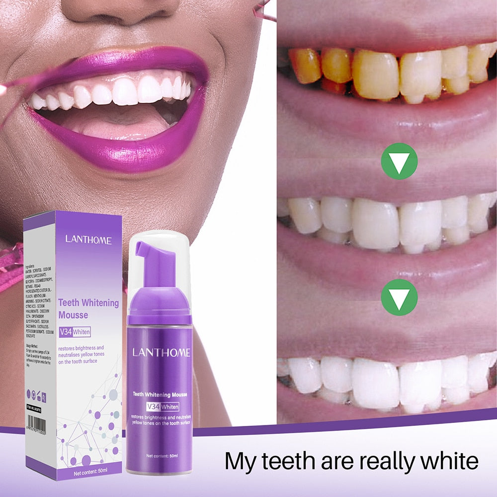 "Unveil Your Radiant Smile: Teeth Whitening Mousse, the Ultimate Solution for Deep Cleaning and Restoring Confidence!"
